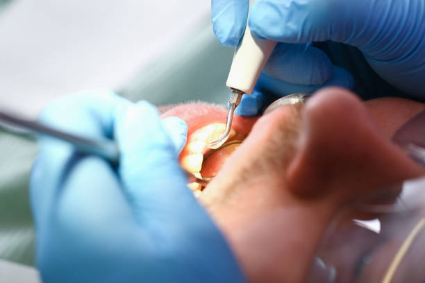 Best Urgent Dental Care for Toothaches in Cactus Flats, AZ
